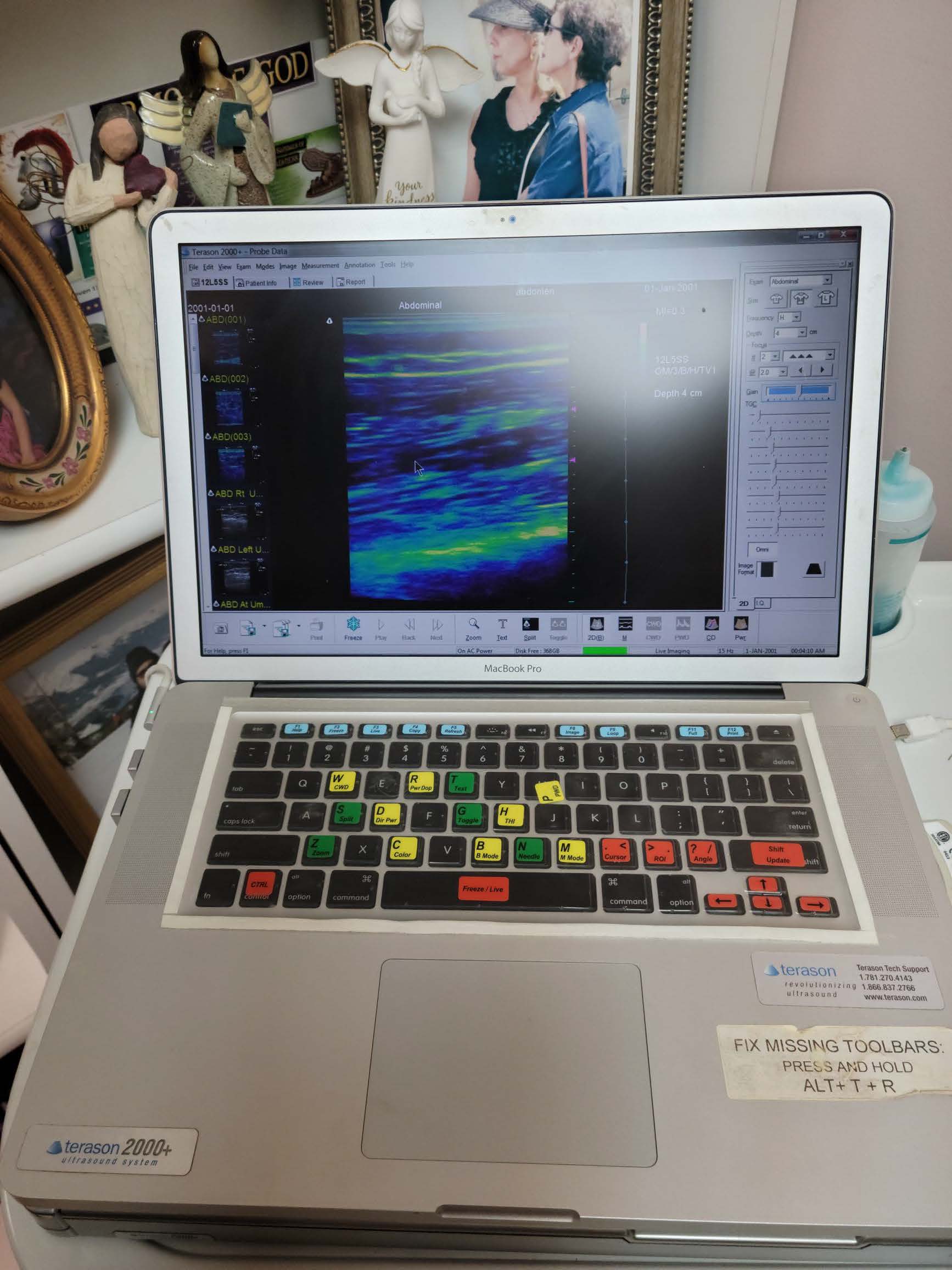  Terason T2000 Ultrasound Laptop