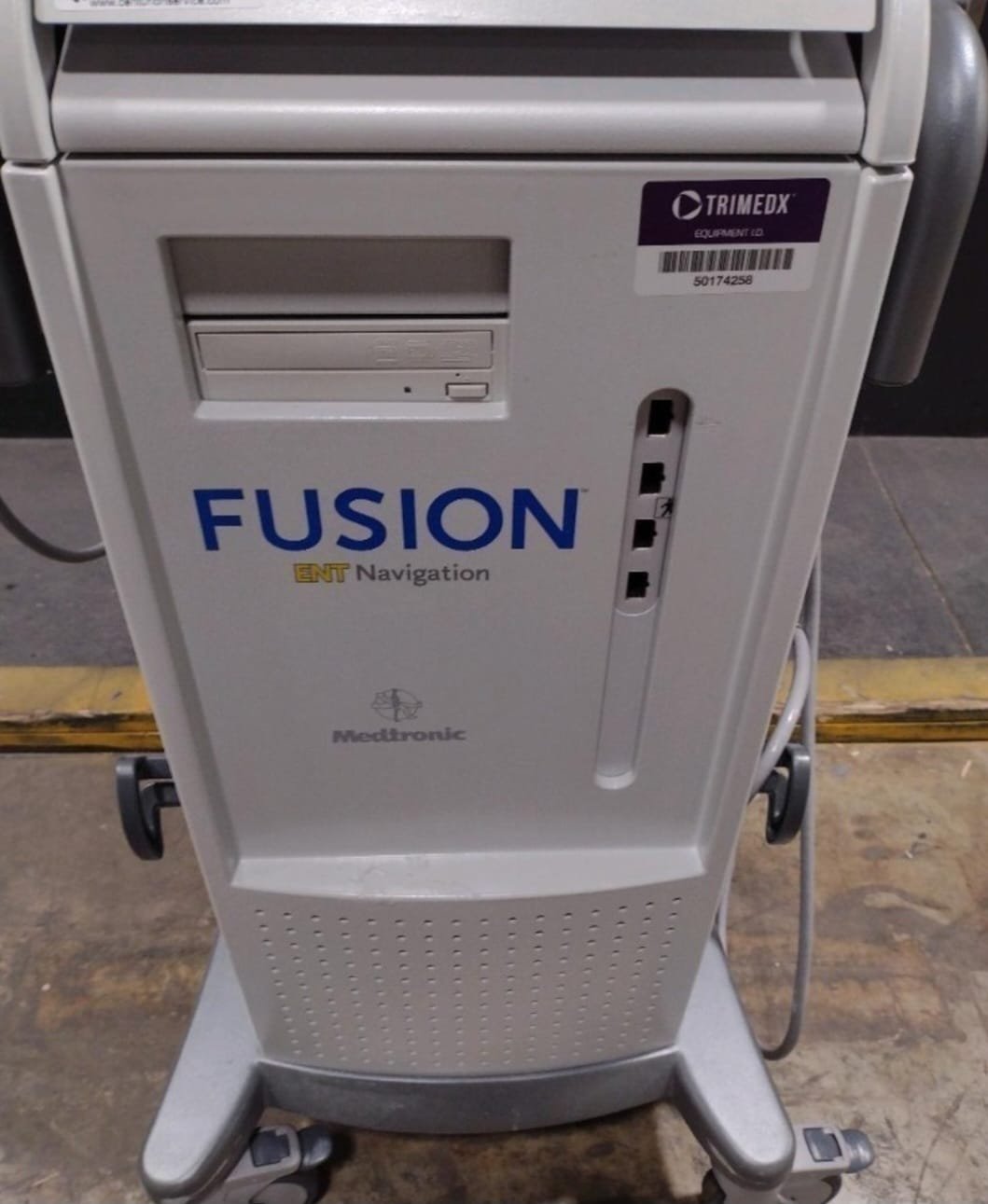 Medtronic Fusion ENT Navigation System