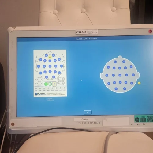 Moberg CNS-300 Neuromonitoring System w EEG Amplifier & Cables – AS-IS for Part
